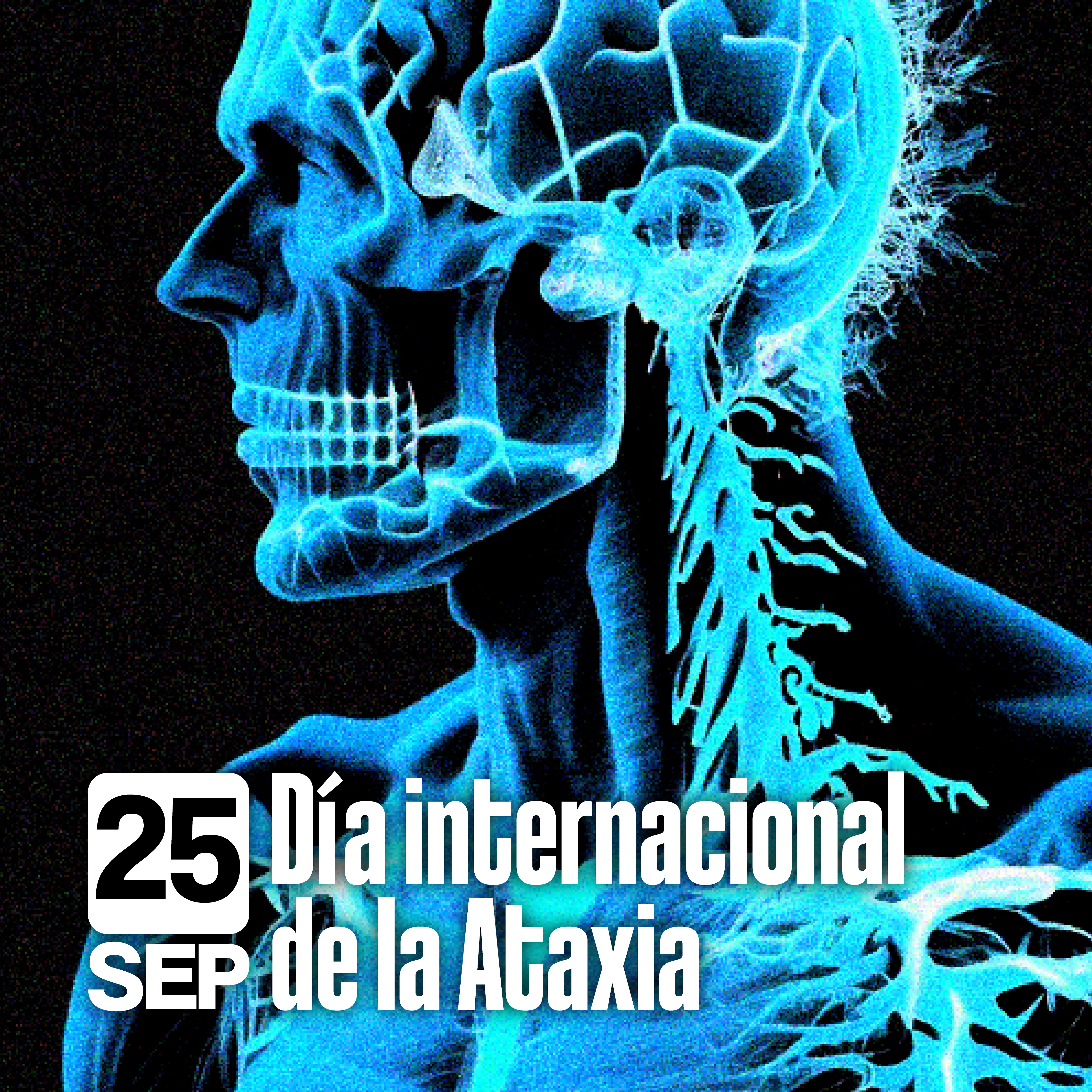 La Ataxia y el Cannabis Medicinal: Un Vistazo desde la Ciencia